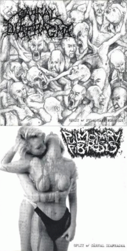 Carnal Diafragma : Carnal Diafragma - Pulmonary Fibrosis